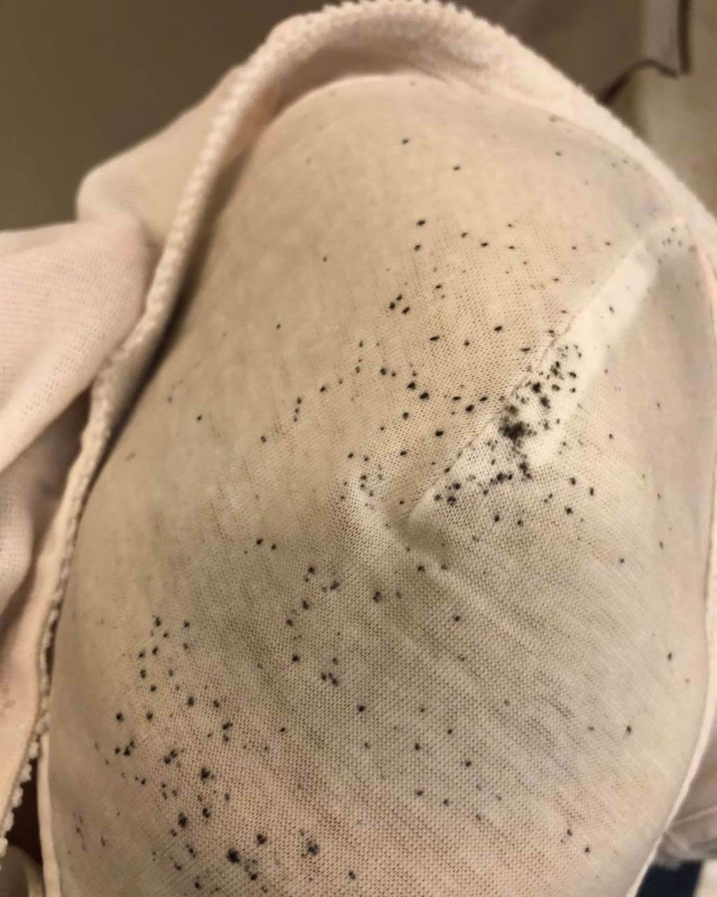 皮膚科醫師分享，近日她被患者布滿密密麻麻「黑胡椒鹽」的內衣給嚇傻。(蔡逸姍提供)