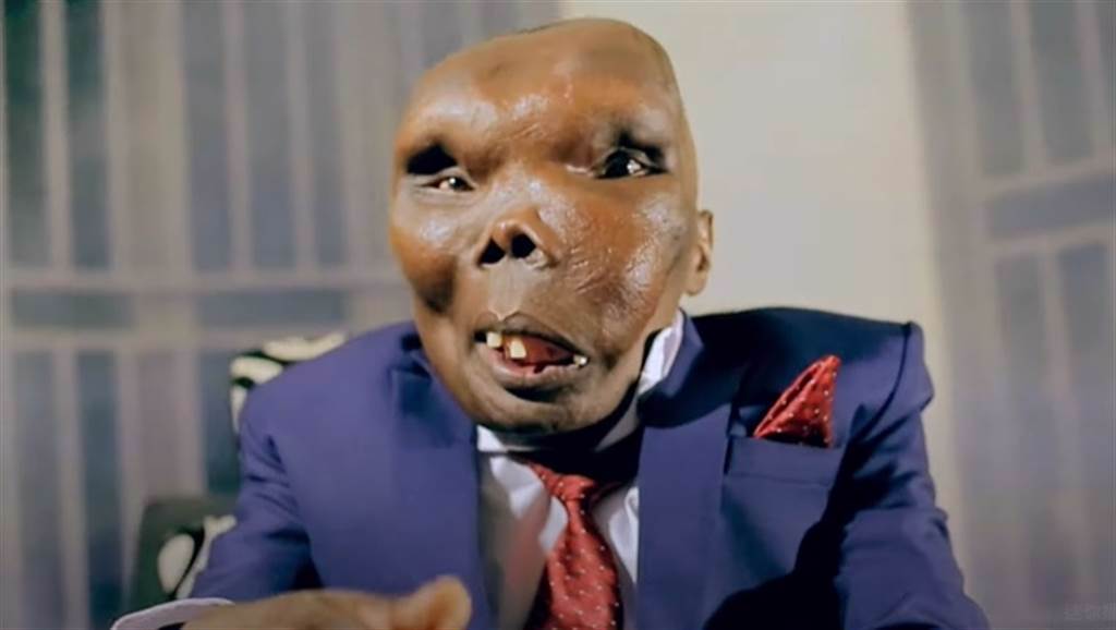 烏干達男子巴古馬因為罹患罕見疾病，導致臉部嚴重變形，2002年參加「世界最醜男人」比賽，沒想到竟一舉奪冠。(圖/擷自YouTube/UGXTRA CELEBRITY BUZZ)