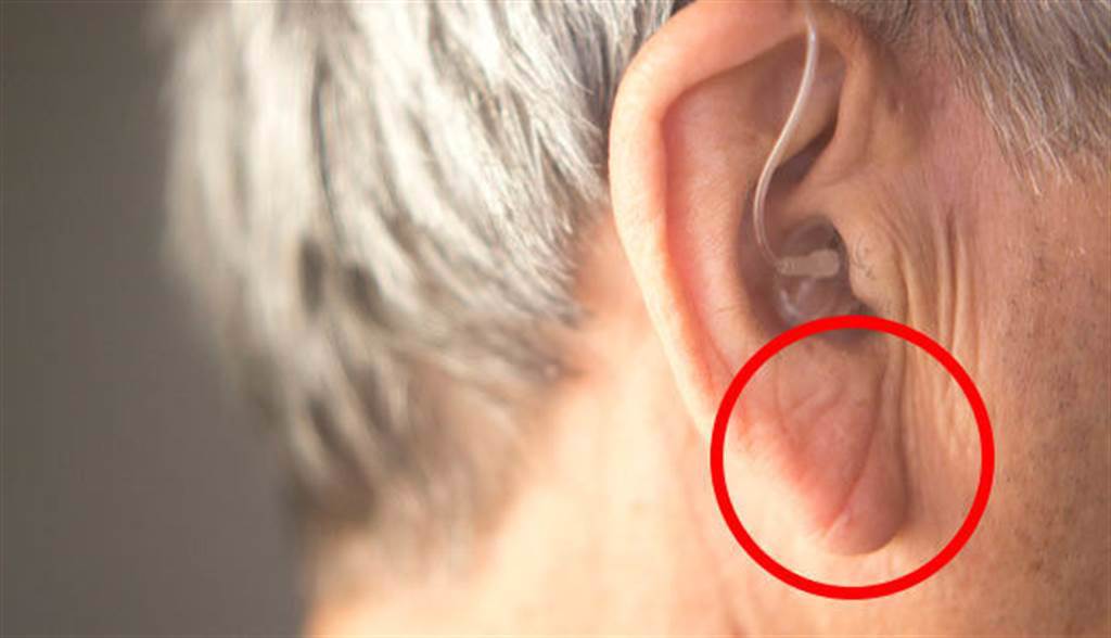 有一說認為，耳垂出現摺痕，發生心肌梗塞的機會較高。(圖/Shutterstock）