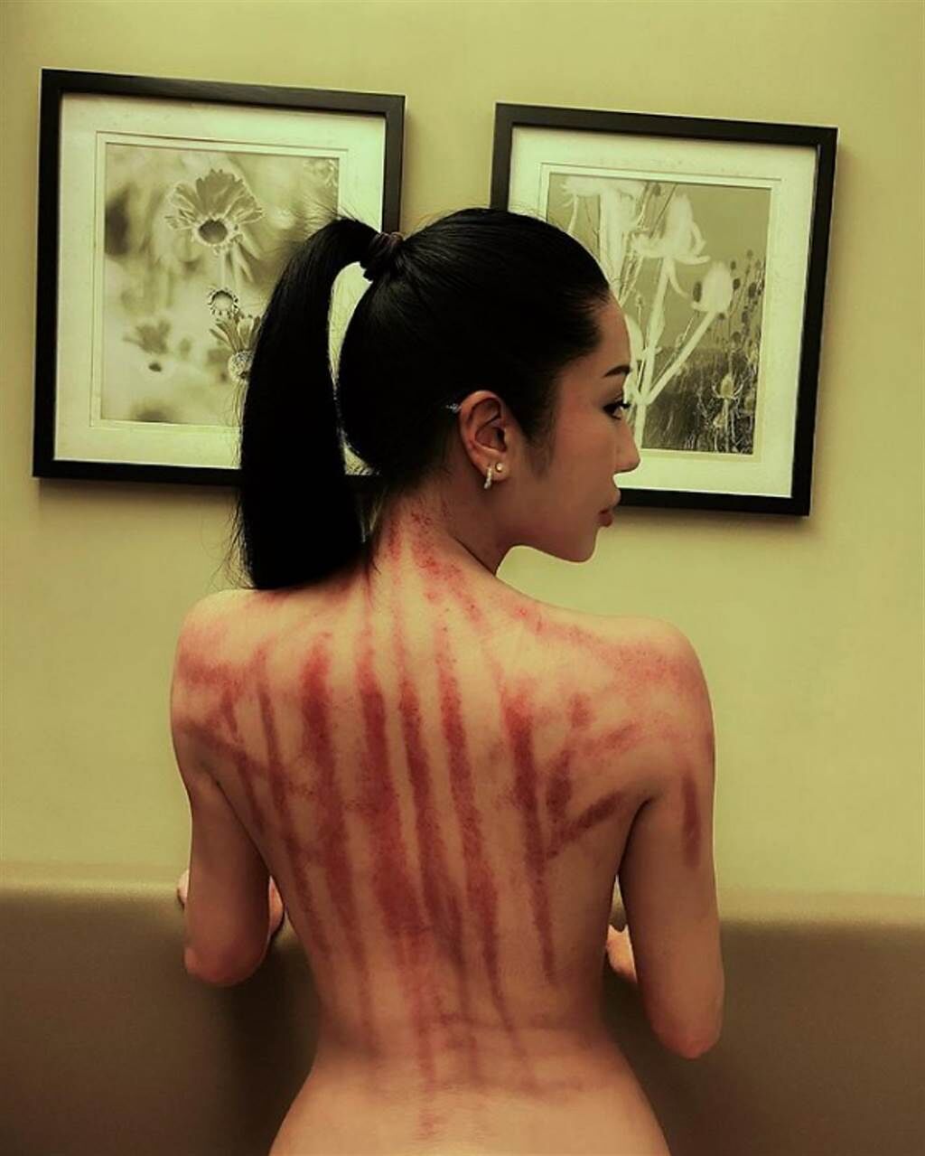 崔碧珈近日曬出一張性感裸背照，背部全是刮痧後的血紅痕跡，驚人畫面也讓粉絲看了既興奮又震撼。(圖/ 摘自崔碧珈IG)