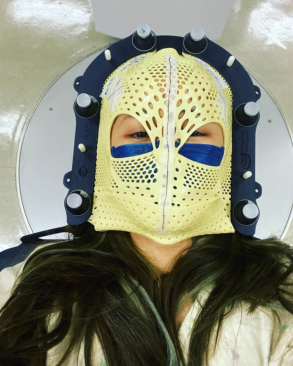 陳筱蕾腦瘤復發，帶著特殊面罩做放射手術治療，自嘲像「德州電鋸殺人狂」。（摘自臉書）