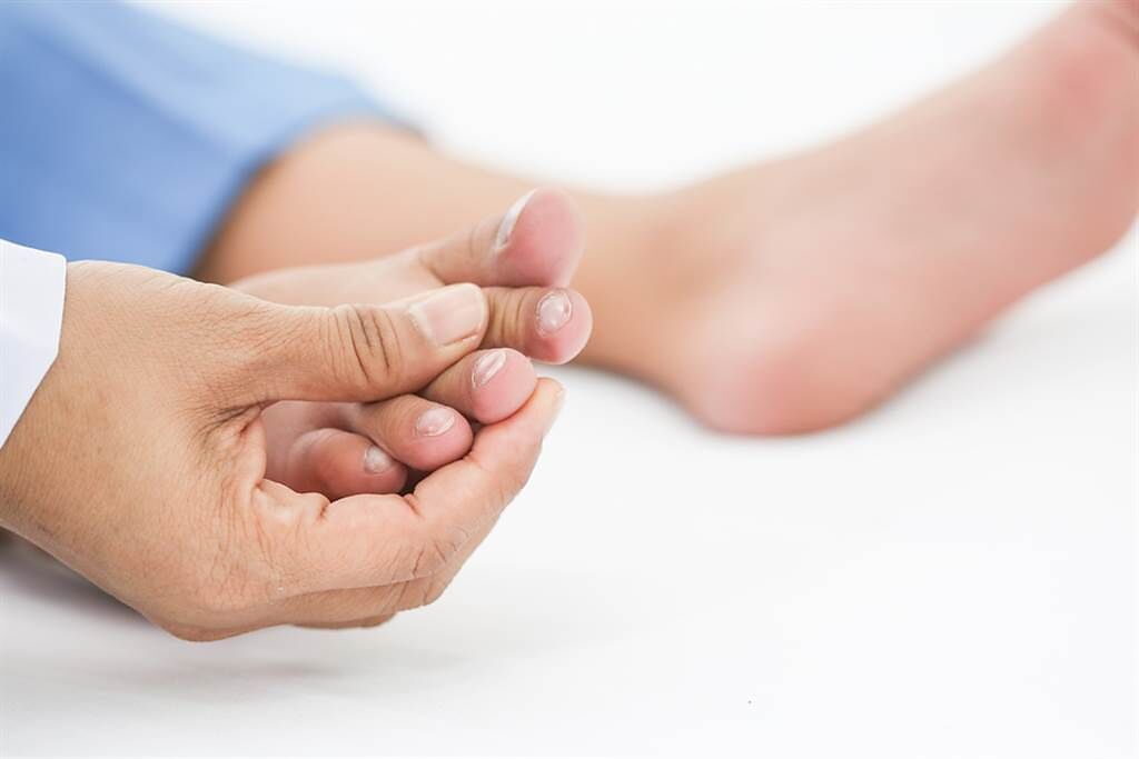 新冠肺炎患者的指甲常有4大狀況，重症醫表示，發病約3個月後，指甲可能完全脫落。（圖／Shutterstock）