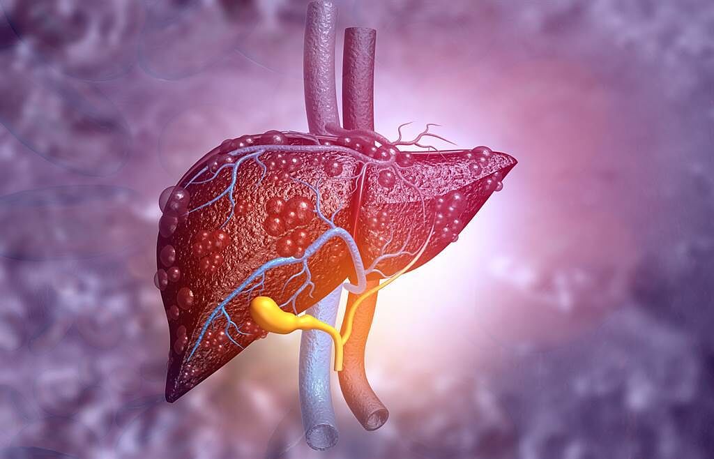 肝癌5大高風險族群莫輕忽 提高篩檢頻率助肝癌早發現。(示意圖/Shutterstock)