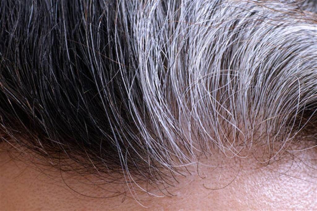 最新研究發現頭髮變白是可逆性的，它可以恢復成原來的顏色！（圖／明日科學）