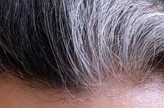 最新研究發現頭髮變白是可逆性的，它可以恢復成原來的顏色！