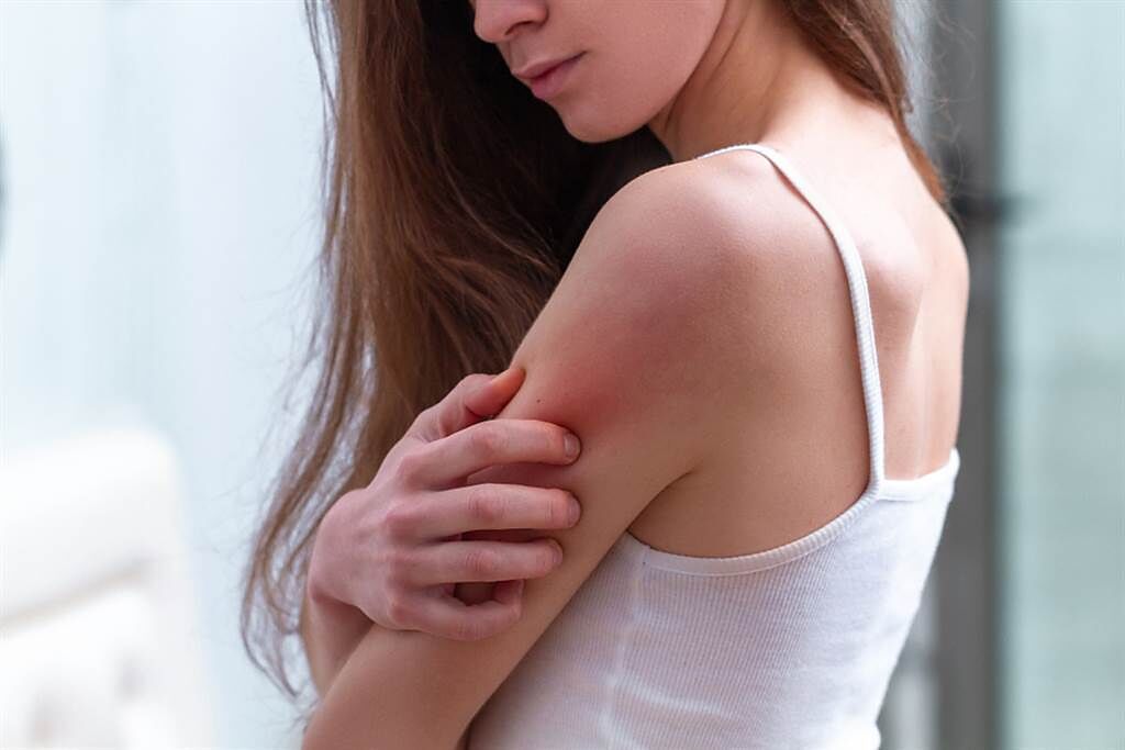乾癬是全身性發炎反應 小心已潛藏心血管共病 大增中風危機。(示意圖/Shutterstock)