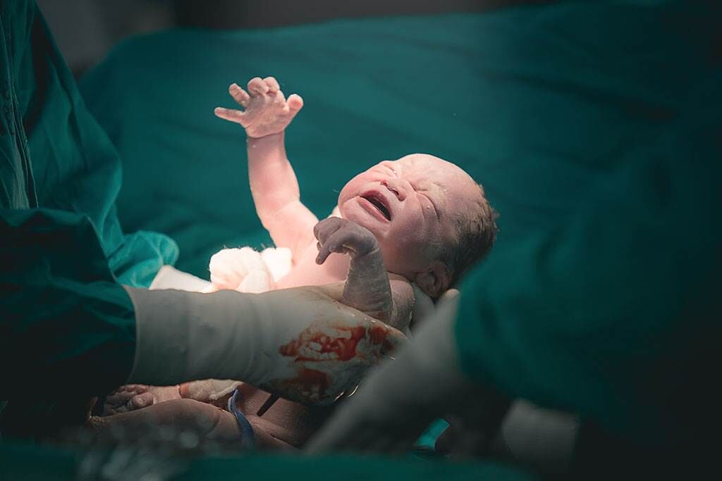 以色列一名初生女嬰的胃裡竟藏有一個不完全胚胎，且已發育出一顆心臟和骨頭。（示意圖／達志影像）