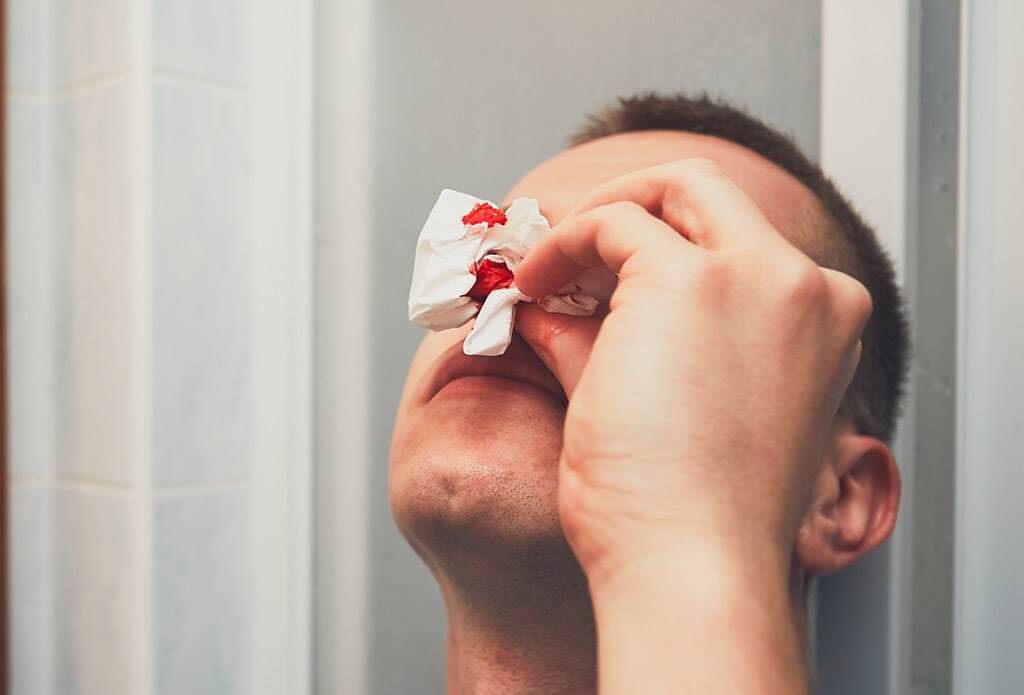 流鼻血時抬頭、紙塞鼻子是錯的！醫：這種狀況恐是鼻咽癌。(示意圖/Shutterstock)