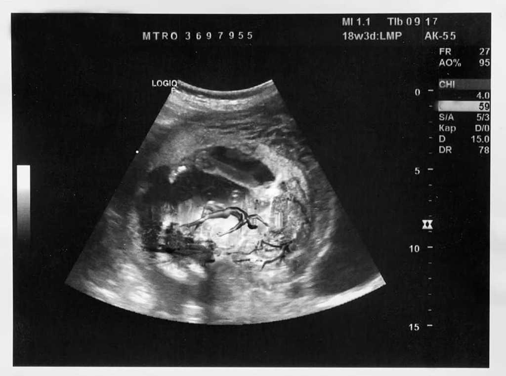 孕肚內的孩子正是納斯小子首張專輯封面《MONTERO》（圖 / 翻攝自Lil Nas FB）