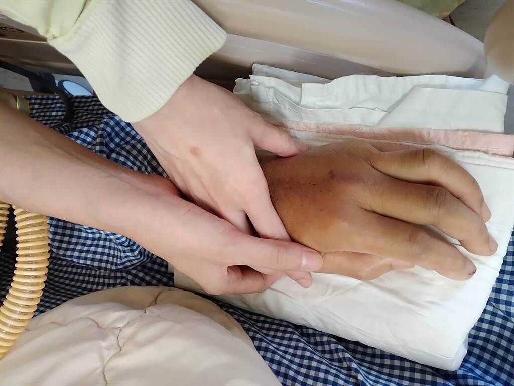 鄭先生因車禍昏迷，兩個女兒緊緊握住爸爸的手，希望能喚醒他。（鄭小姐提供）