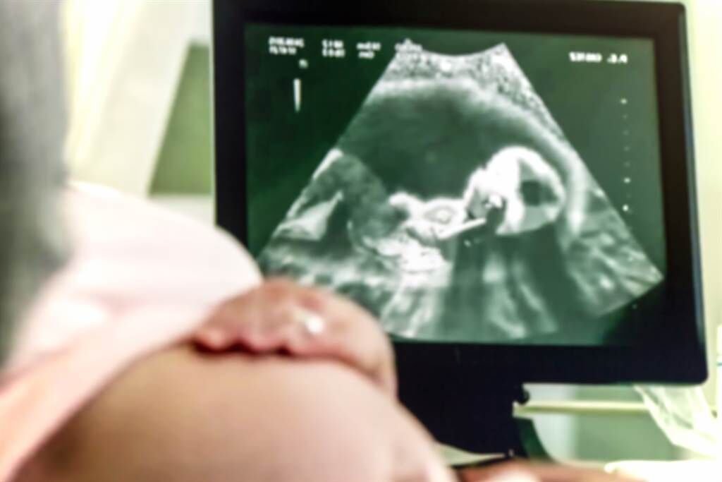 英國一名孕婦照超音波時，發現畫面中多出一張臉，認為應該是先前流掉的孩子回來了。(示意圖/達志影像)