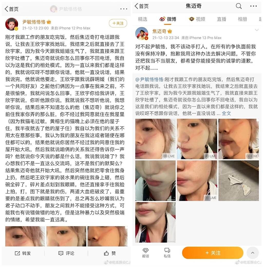大陸歌手尹毓恪在微博上公開傷照，焦邁奇則趕緊發文道歉。（圖／微博）
