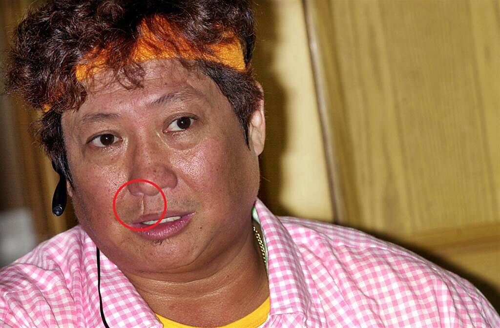 洪金寶臉上的疤痕，有香港資深記者爆料是黑道男星陳惠敏留下的。(圖/ 取自中時資料庫，楊約翰攝)