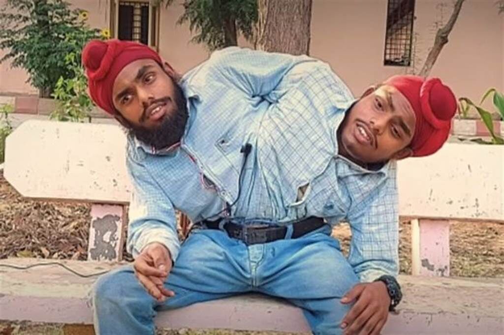 印度一對連體雙胞胎近日獲得人生第一份工作，在旁遮普電力公司擔任電氣工。(圖/翻攝自推特)