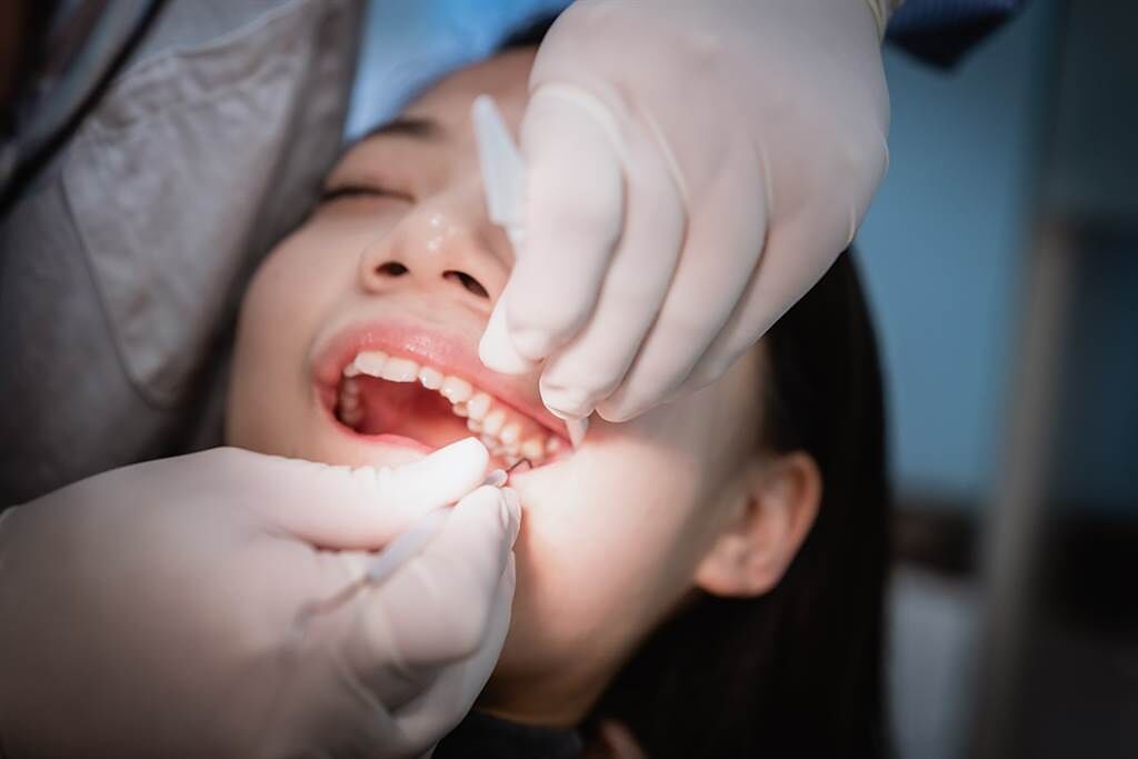 大陸一名女子日前去拔智齒，沒想到她的牙齒非常牢固，牙醫師花了1小時才拔下來。(示意圖/達志影像)