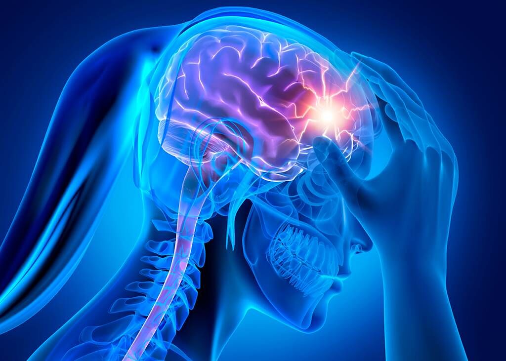 「暴烈性頭痛」是腦出血前兆！死亡率破3成。(示意圖/Shutterstock)