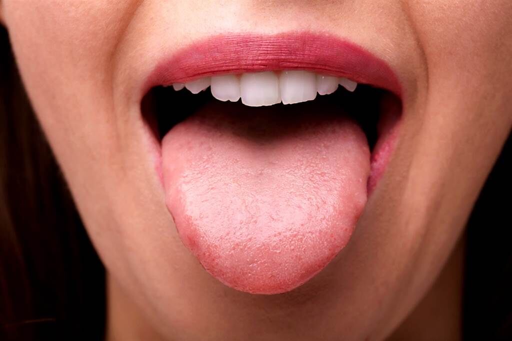 英國女子華勒絲（Olivia Wallace）在舌頭上發現一顆腫塊，原本以為是性病，讓她羞於看醫生，拖了7個月才就診，竟確診罹患舌癌，而且已經進入第四期。（示意圖／shutterstock）