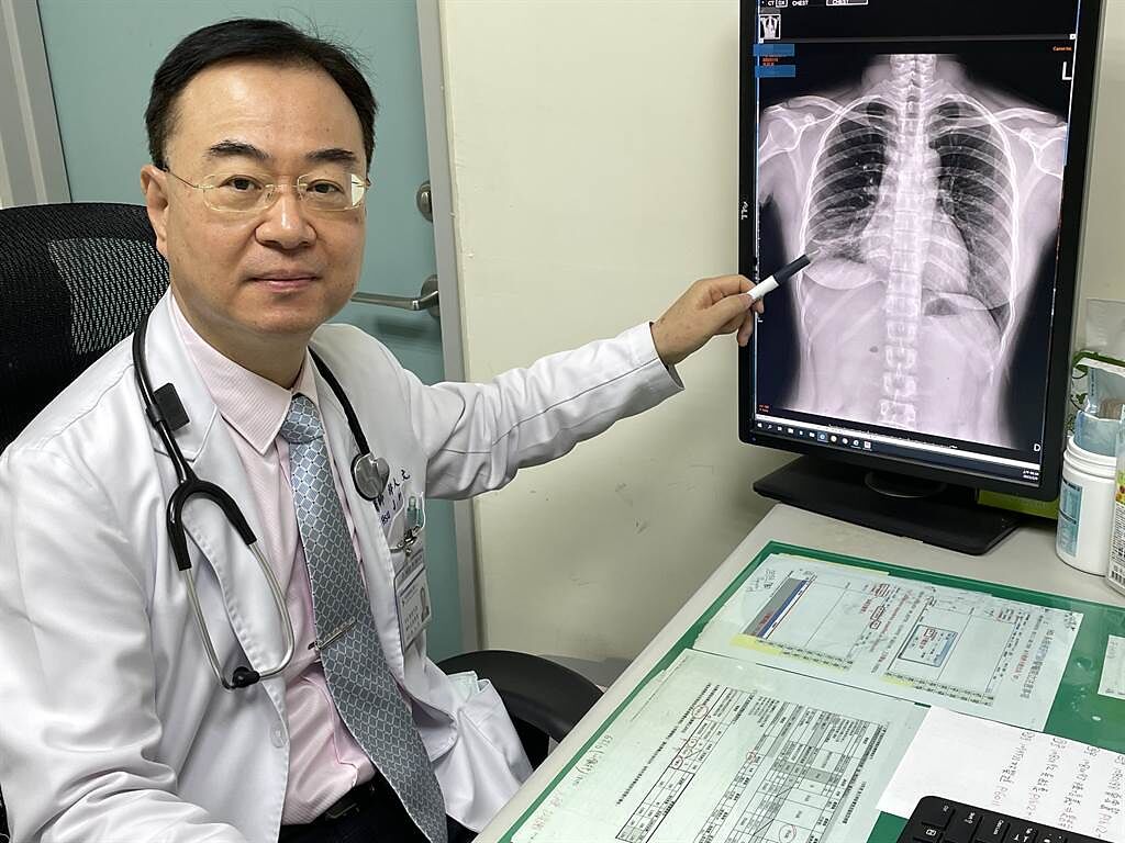 烏日林新醫院胸腔內科醫師許人文透過X光片，解釋開放性肺結核的肺葉浸潤情況。（烏日林新醫院提供／林欣儀台中傳真）
