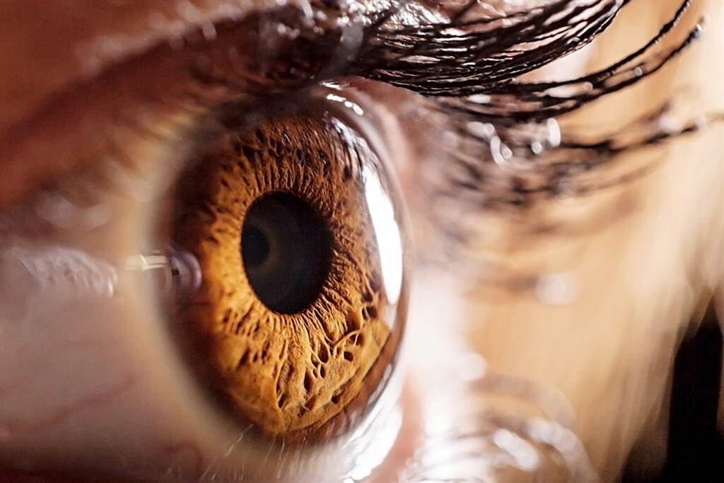有2種重要的眼睛疾病，用手電筒就能檢查，若出現異常最好盡快就醫，否則恐怕要摘除整個眼球。(示意圖/達志影像)