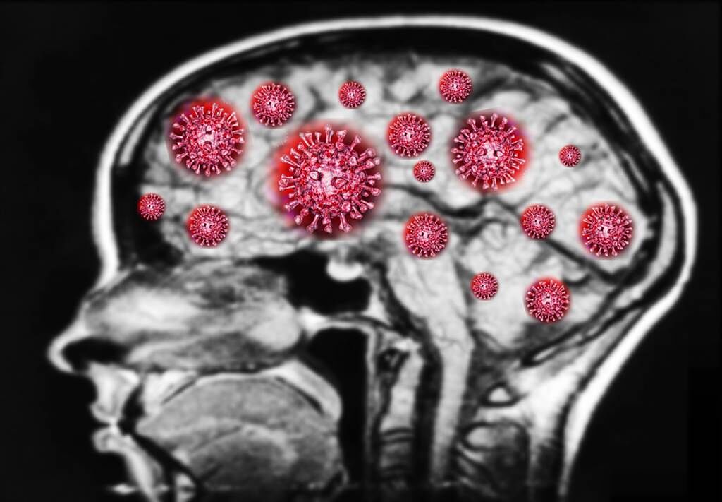 感覺失智上身？醫曝：病毒入侵也會害人腦霧。(示意圖/Shutterstock)