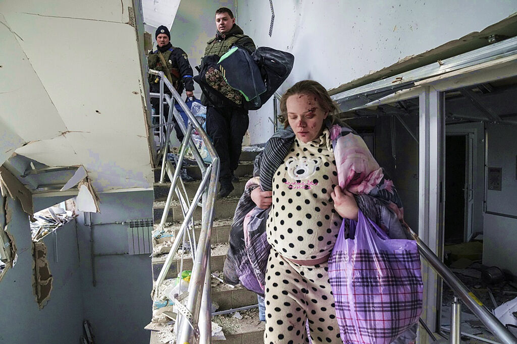 俄軍9日轟炸馬立波（Mariupol）的婦幼醫院，外媒拍到孕婦挺著大肚、臉上沾血逃難，讓俄羅斯砲轟是女演員維舍吉爾斯卡婭（Mariana Vishegirskaya）演的。（圖／美聯社）