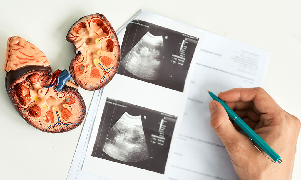 慢性腎臟病年奪5千命 高腎壓恐害腎臟「破洞」 7特徵快注意。(示意圖/Shutterstock)