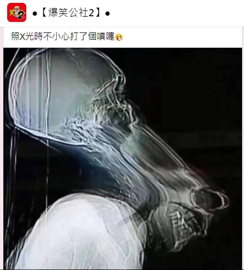 網友分享照片並註解：「照X光時不小心打了個噴嚏」，讓眾多網友笑翻。（截自臉書《●【爆笑公社2】●》）