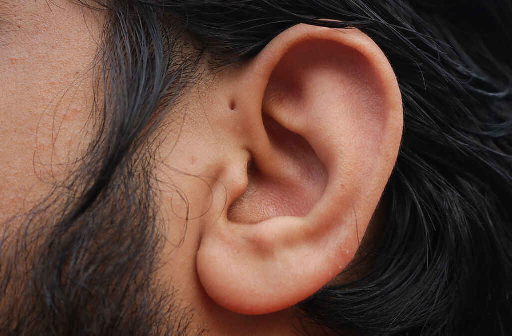你的耳朵上也有小黑洞嗎 ？ 「耳前廔管」竟是先天性疾病。(示意圖/Shutterstock)
