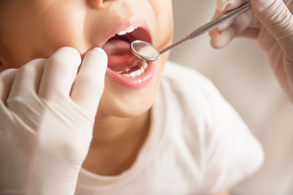 牙醫師提醒，長期缺牙會增加失智症風險，千萬不能置之不理。（示意圖／達志影像）