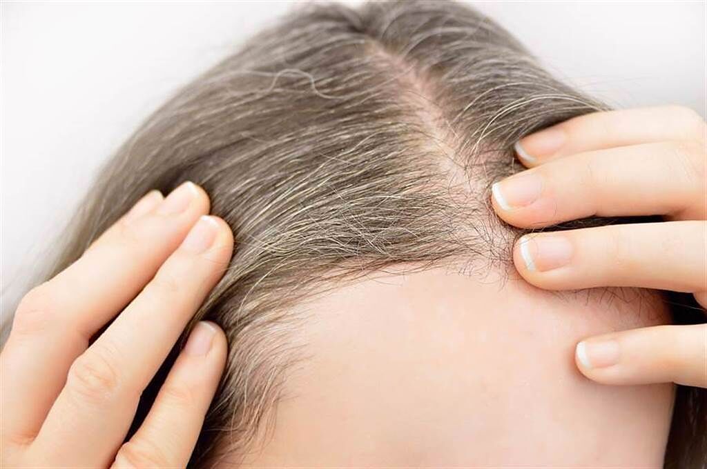 白髮常染怕傷身 醫：黑色素細胞死光前 有辦法自然黑回來。(示意圖/Shutterstock)
