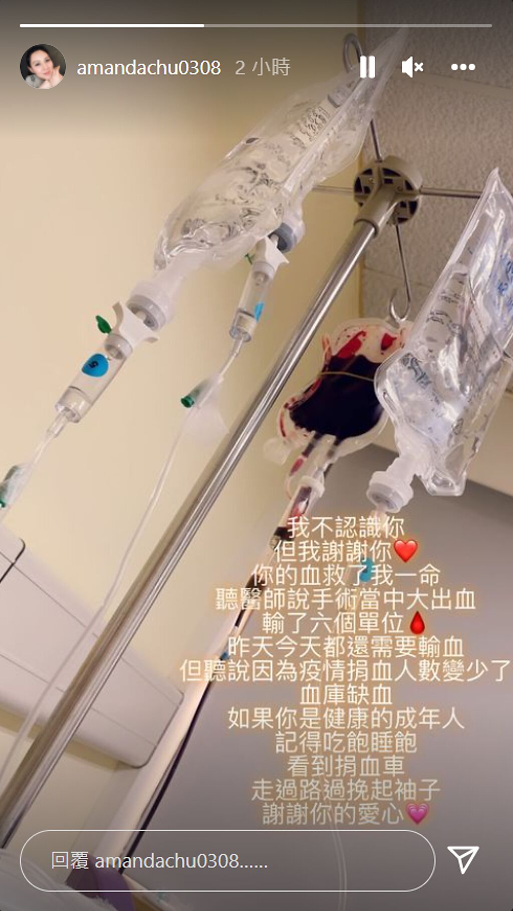 朱芯儀發限動表示曾大出血，好險有人捐血給她這才度過難關。(圖/朱芯儀 IG)