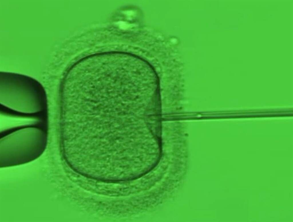 借重「精蟲顯微注射技術(ICSI)」的幫助，強迫與卵子進行受精。（茂盛醫院提供／馮惠宜台中傳真）
