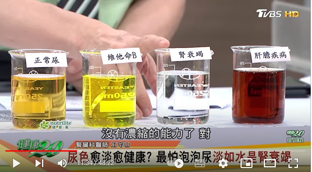 若是尿液的顏色很深如濃茶一般（右一），可能是肝膽疾病，必須趕快就醫。（圖／取自《健康2.0》）