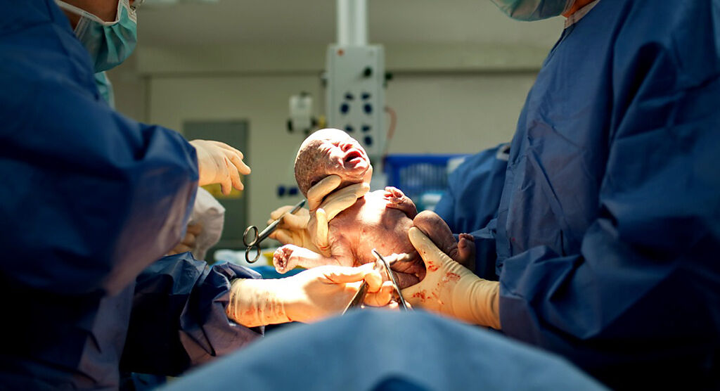 印度一名醫生提前3個月為一名孕婦剖腹，打開肚子後發現胎兒還太小，又趕緊縫合傷口。（示意圖／shutterstock）