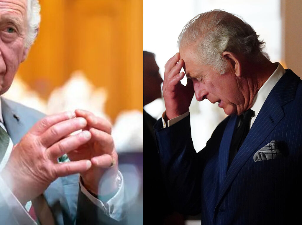 73歲的新英王查爾斯三世（King Charles III）腫脹的手指再度曝光，引發民眾憂心。
(圖/截自推特、美聯社)