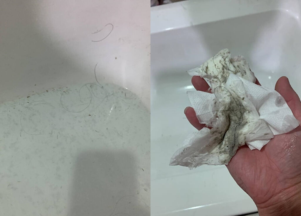 人妻拍下老公「1個月不洗澡」的結果，看到毛髮、汙垢非常無奈。（翻攝自臉書匿名2公社）