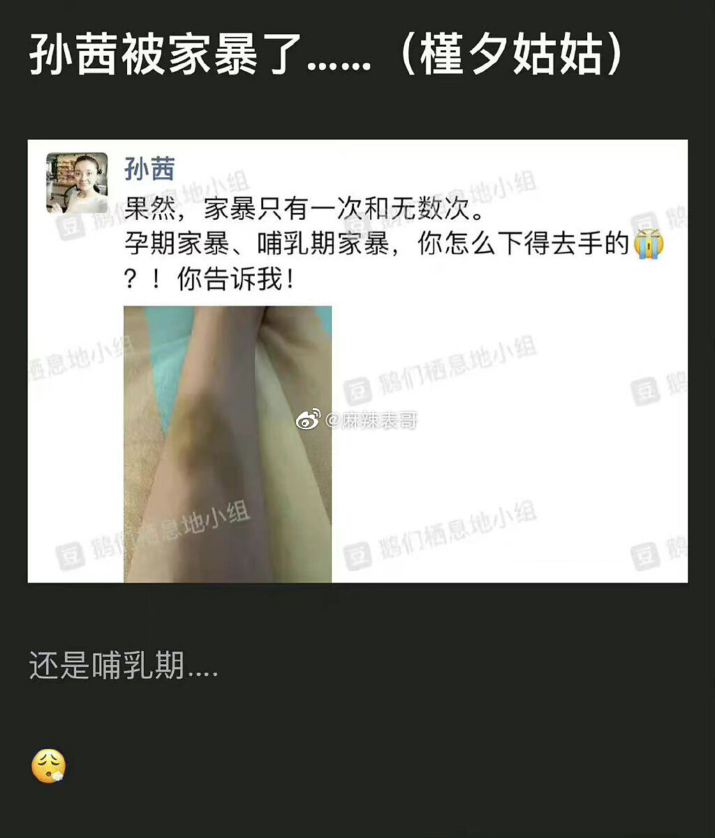 微博瘋傳疑似孫茜遭家暴受傷的照片。(微博)
