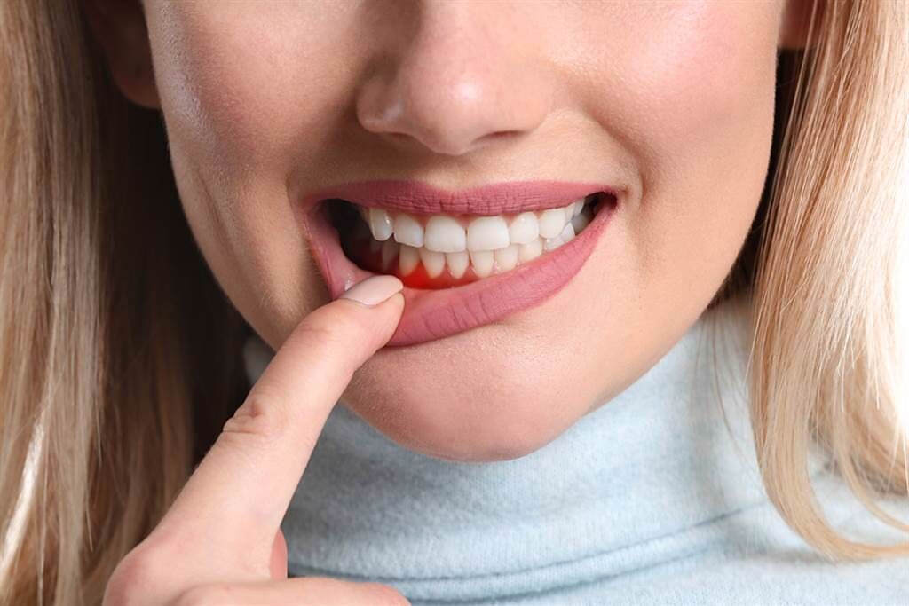 一刷牙就流血，難免讓人心生恐懼。( 示意圖／Shutterstock )

