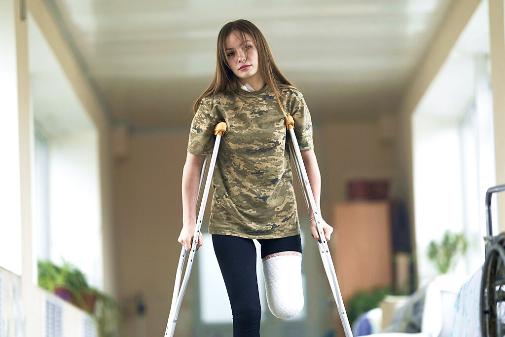 烏克蘭18歲女孩魯斯蘭娜（Ruslana Danylkin）自願上戰場前線擔任通信兵，她日前遭到俄軍轟炸，一條腿被炸斷，差10秒就喪命，最終奇蹟生還。（圖／美聯社）